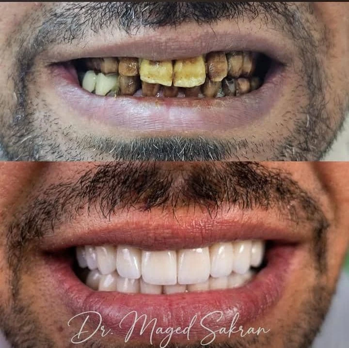 صناعة الابتسامة